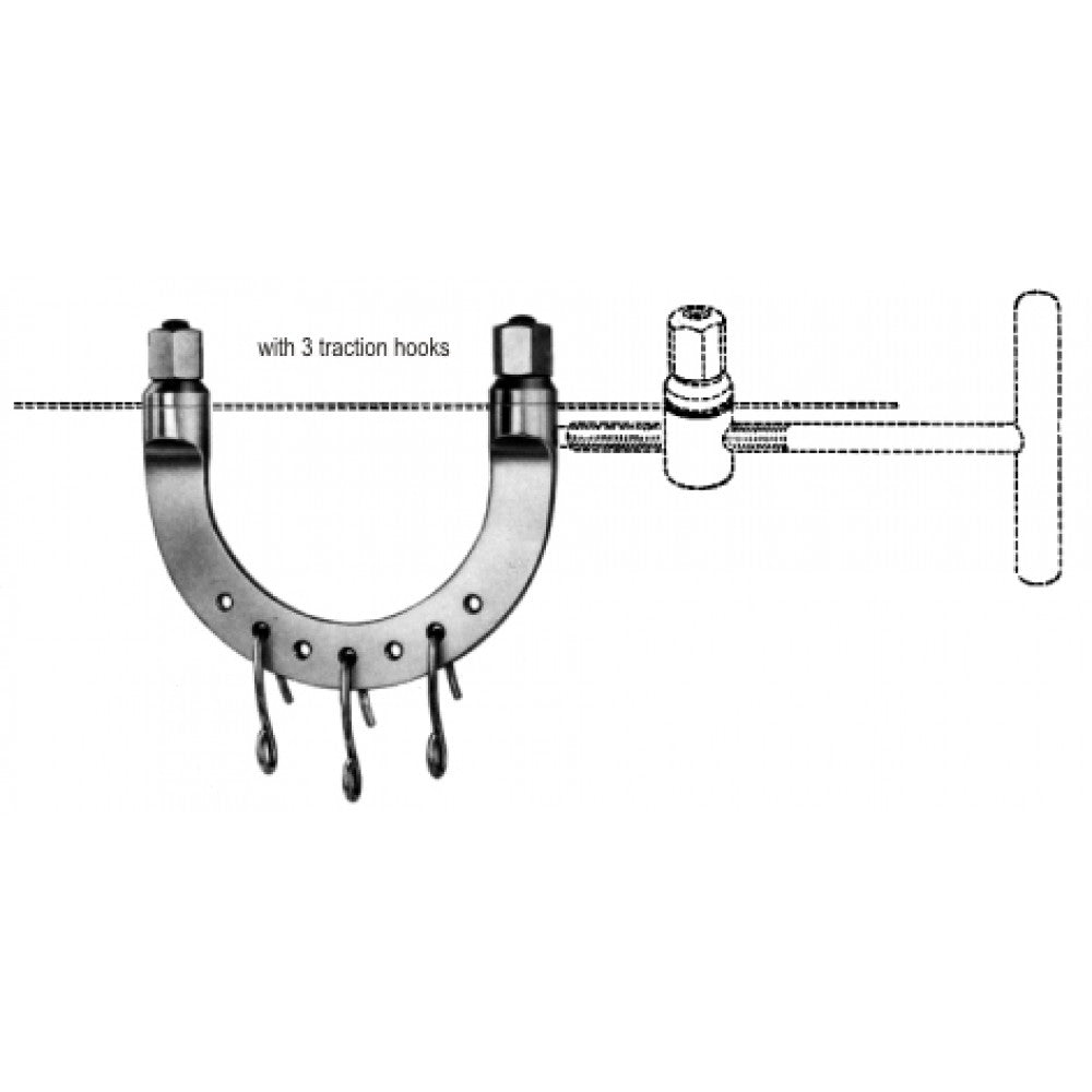Kirschner Extension Bow 95x70mm – Surgix Instruments